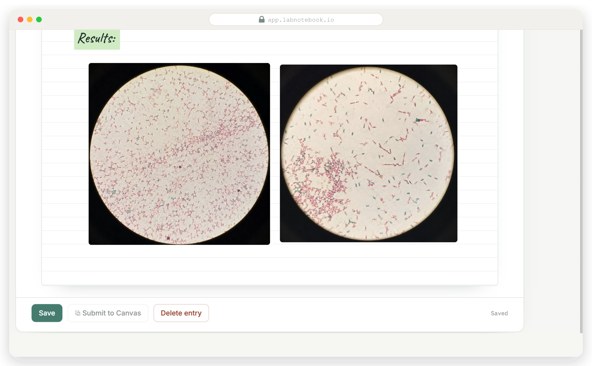 A Lab Notebook page with the Results section and two endospore-stain photos on the ruled canvas